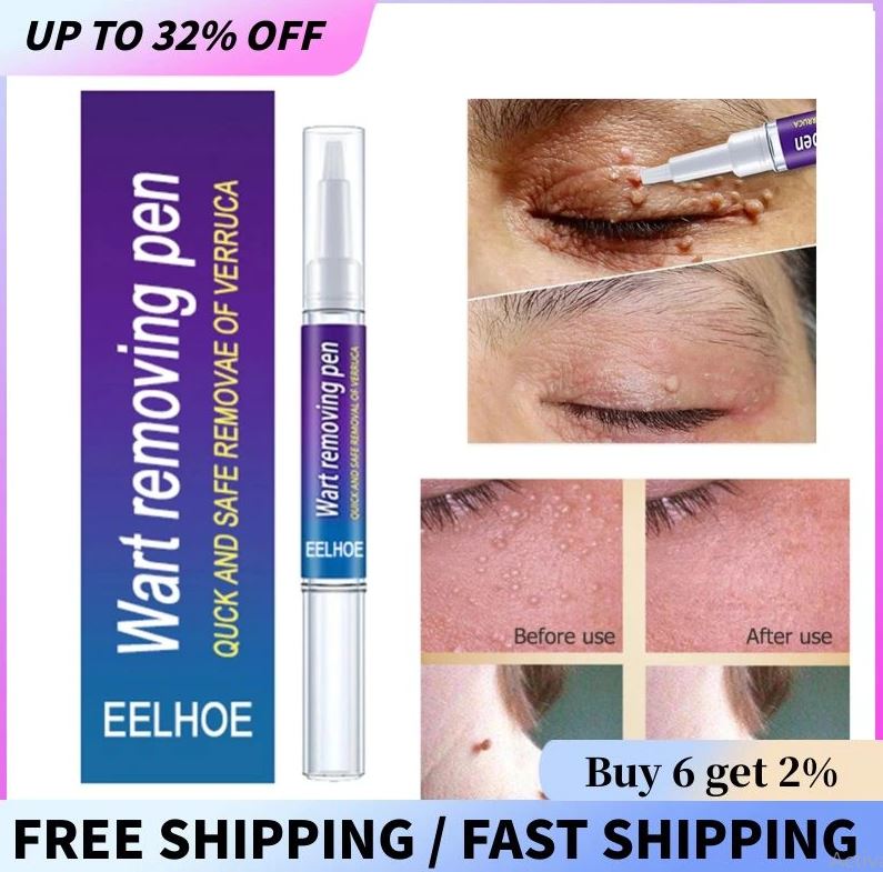 Skin Tag Wart Mole Remover Pen